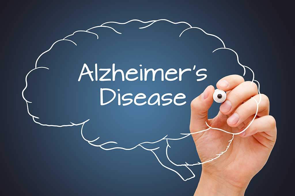 five-facts-about-alzheimer-s-disease-terrabella