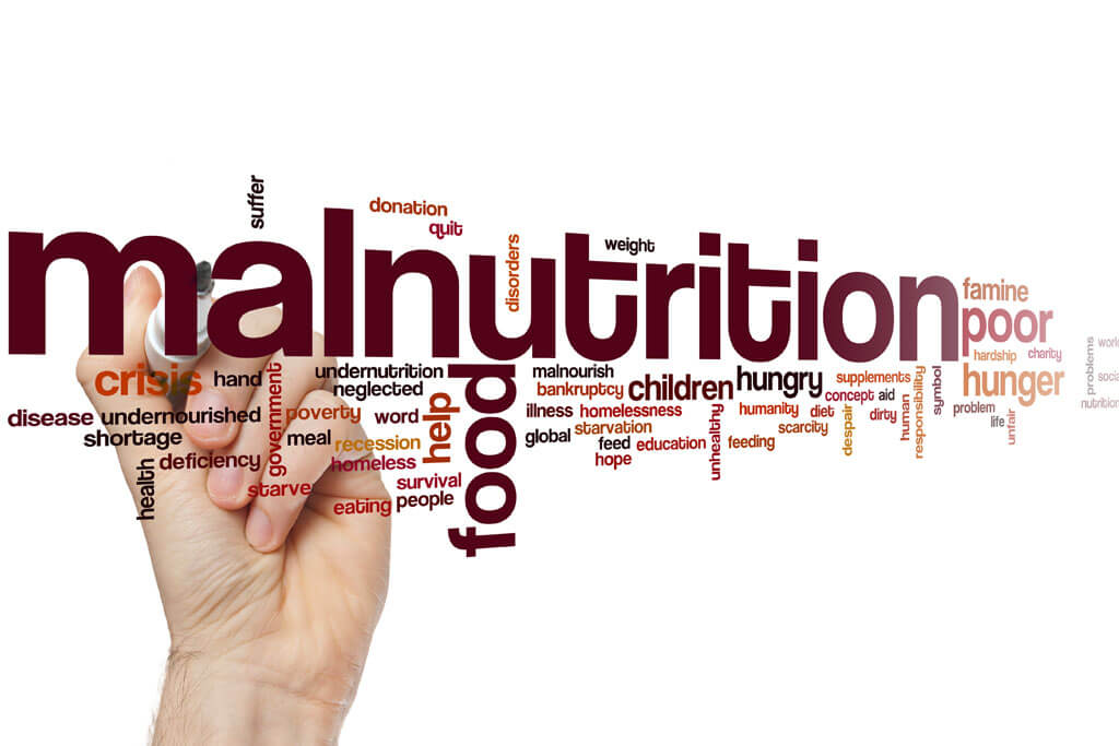 detecting malnutrition in u