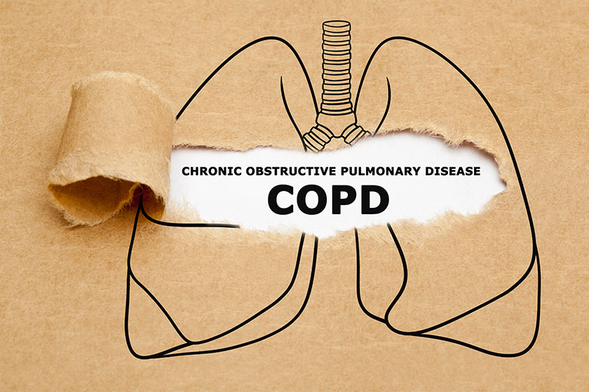 text chronic obstructive pulmonary disease copd appearing torn brown paper text chronic obstructive pulmonary disease copd appearing torn brown paper