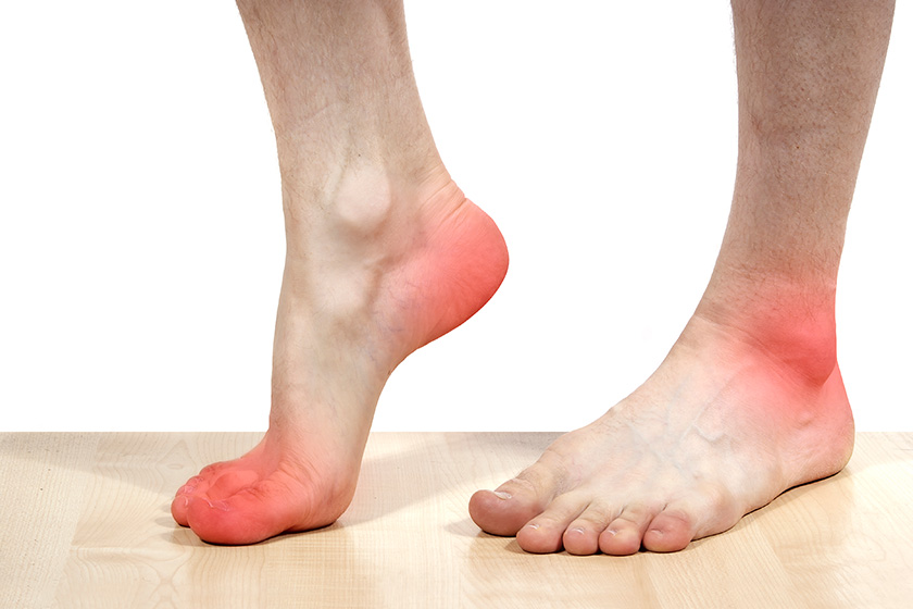 isolated disease of the feet