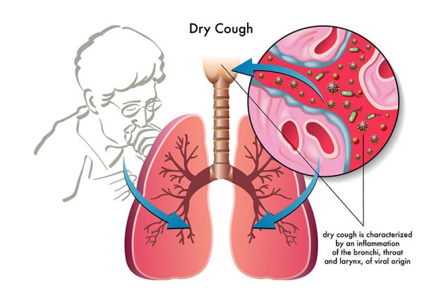 human dry cough