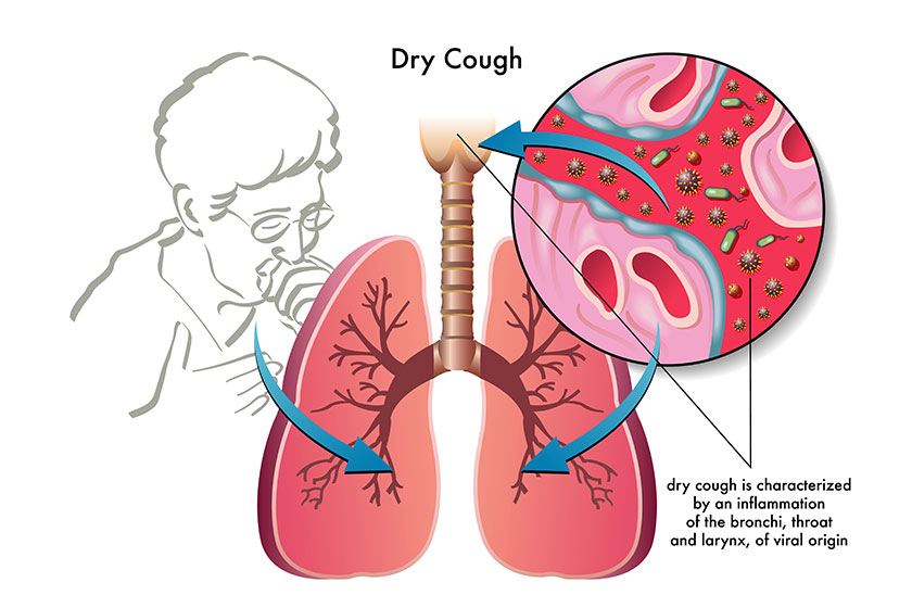 human dry cough