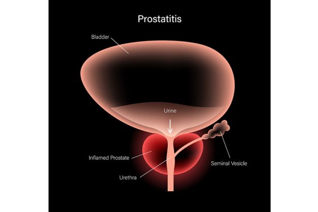 normal bones concept