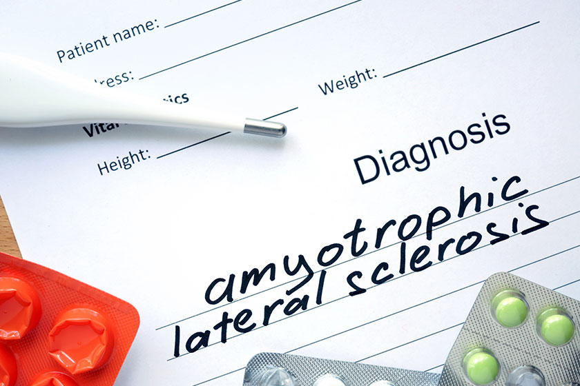 Diagnostic form with diagnosis amyotrophic lateral sclerosis als and pills