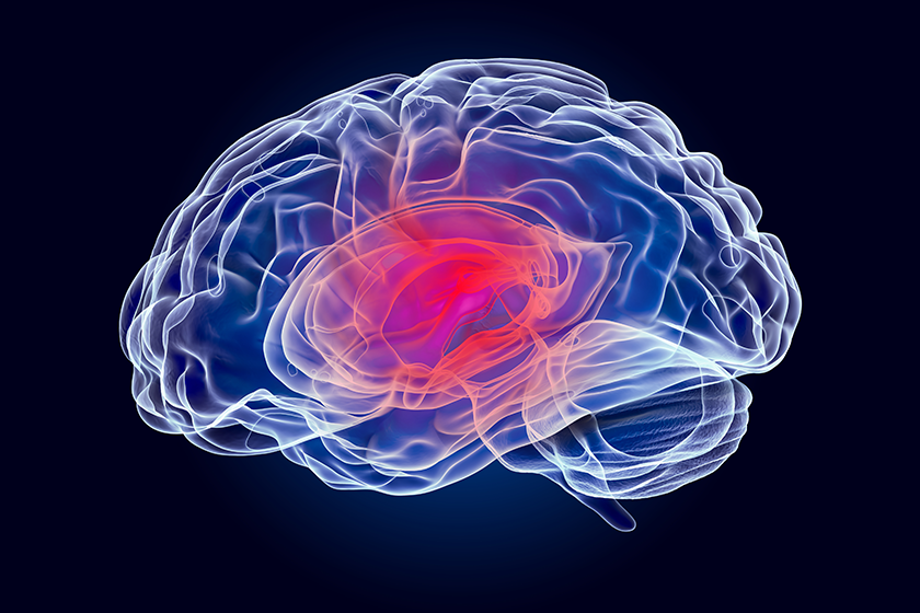 brain disease concept x ray hologram 3d