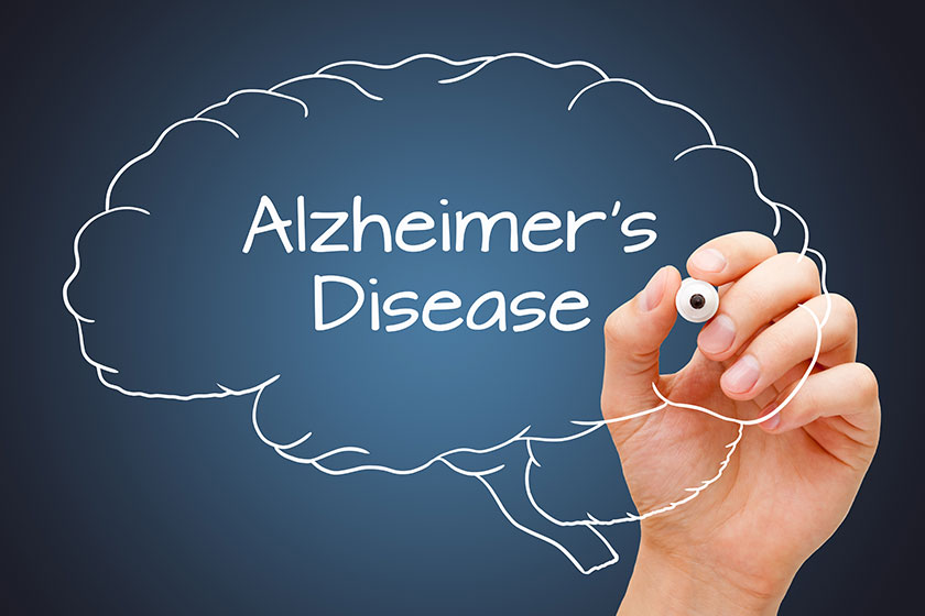 Hand writing alzheimers disease drawn human brain white marker dark