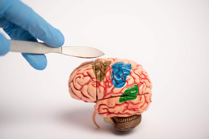 cropped view surgeon holding scalpel brain model