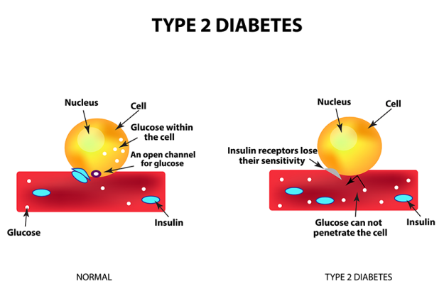 the absorption of glucose by the cell type 2 diabetes