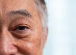 fast growing cataracts (1)