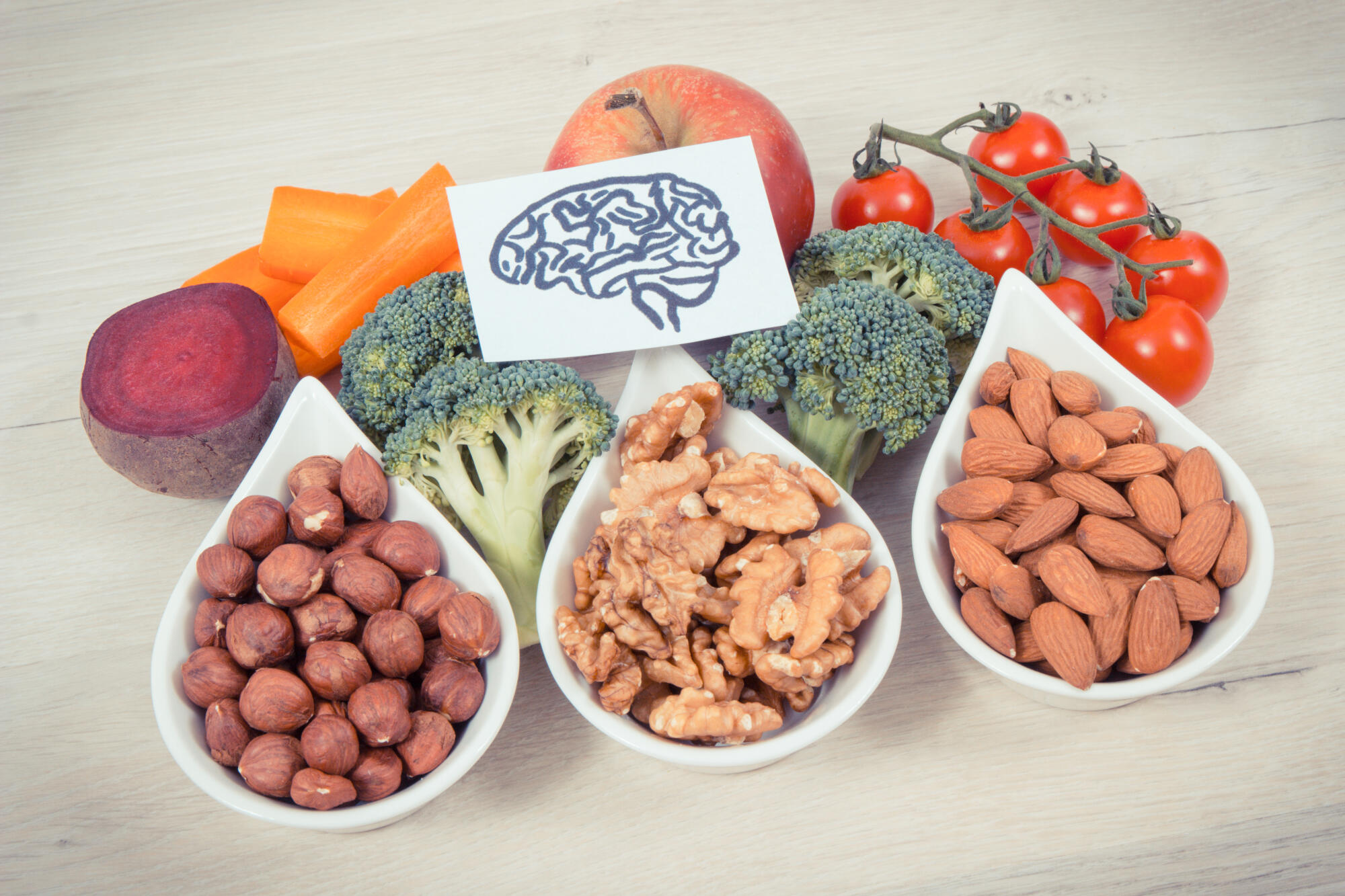 Vintage,Photo,,Drawing,Of,Brain,And,Best,Food,For,Health